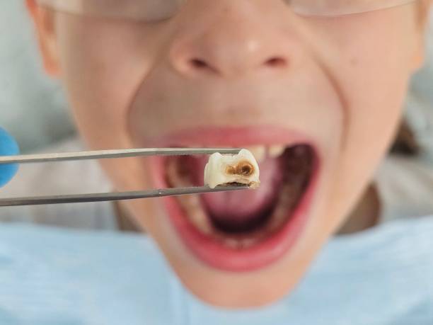 Best Same-Day Emergency Dental Services in Mount Union, PA